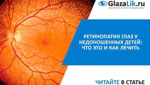 лечение ретинопатии глаз у недоношенных